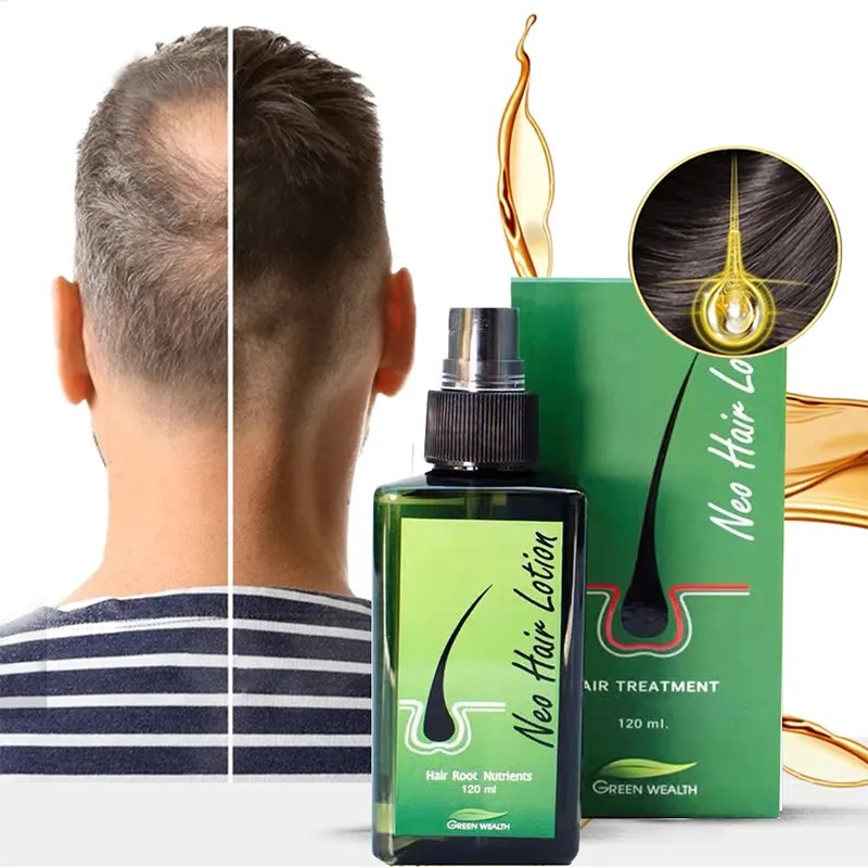 نيو هير لوشن علاج تساقط الشعر الأصلي NEO HAIR LOTION