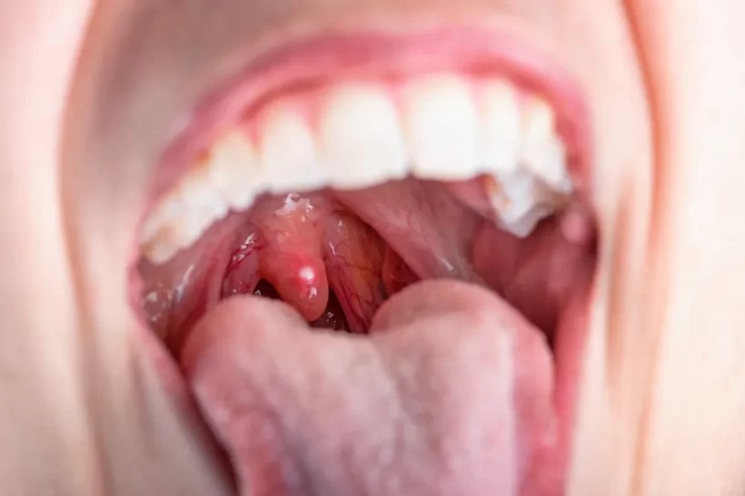 بخاخ التهاب الحلق و الفم سانافوكس 30 مل Sanavox
