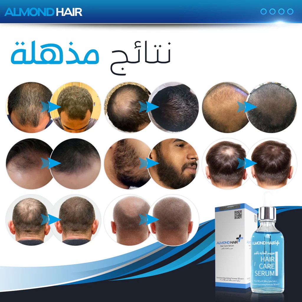 الموند هير ALMOND HAIR سيروم تطويل و تكثيف الشعر للرجال