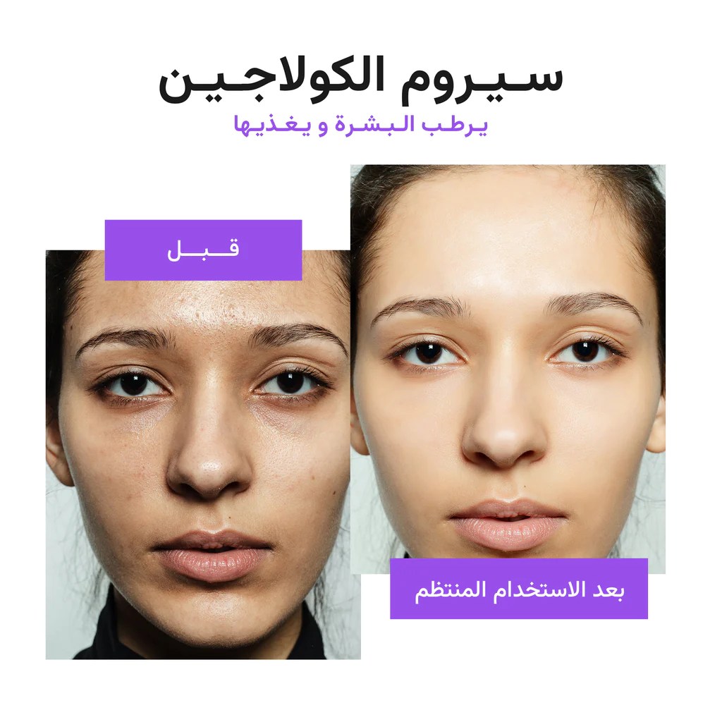 الموندبيوتي سيروم الكولاجين لتصحيح التجاعيد ALMOND BEAUTY