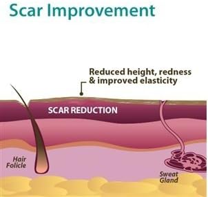 PROCIL GEL بروسيل جل لعلاج اثار الجروح و الندبات